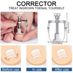 15 Pieces Ingrown Toenail Tools Stainless Steel Foot Nail Tools, Toenail File and Lifter, Nail Clipper, Cuticle Cutters, Cuticle Pusher and Manicure Pedicure Tools for Ingrown and Thick Nail (Black) - Image 2